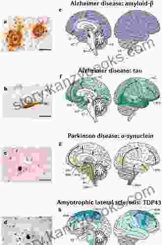 Fatal Attractions: Protein Aggregates In Neurodegenerative Disorders (Research And Perspectives In Alzheimer S Disease 14)